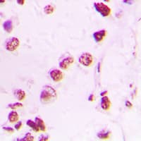 EP300 / p300 Antibody (N-Terminus)