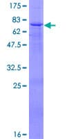 Human SERPINA4 / Kallistatin Protein (Recombinant GST)