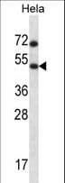 LW-1 / HSFX1 Antibody (aa201-230)