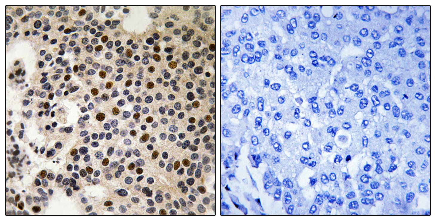 PAK2 Antibody (phospho-Ser197)