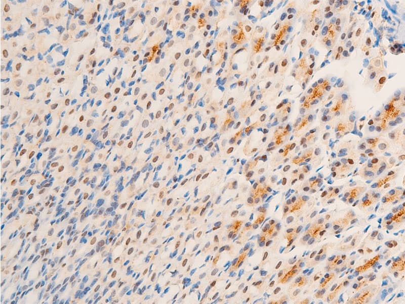 NR3C1/Glucocorticoid Receptor Antibody (phospho-Ser203)