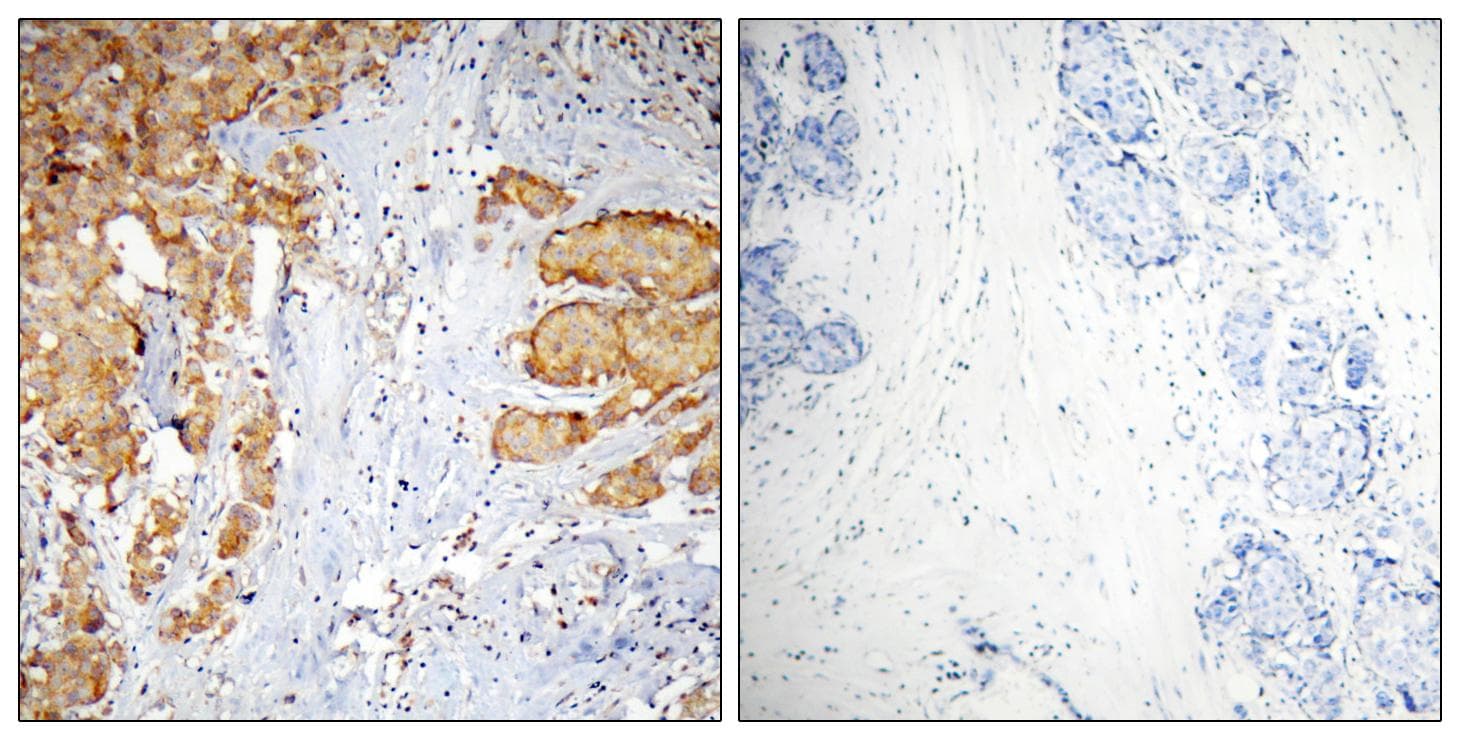 Polyclonal Rabbit anti-Human VASP Antibody (p278, IHC, WB)