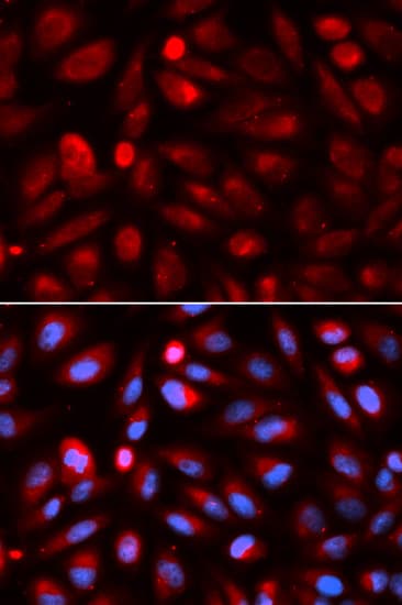 ACP5 / TRAP Antibody