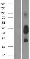 CEACAM19 Protein (Over-Expression Lysate Myc-DDK (Flag))
