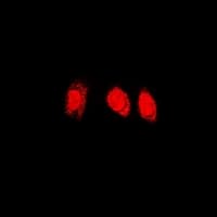 Polyclonal Rabbit anti-Human PSMC4 Antibody (IF, WB)