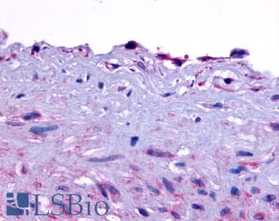 PathPlus™ EDNRA / Endothelin A Receptor Antibody (Extracellular Domain)