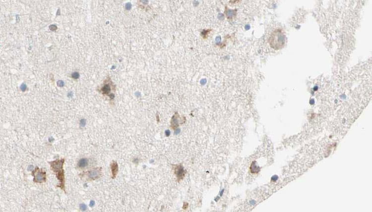 Polyclonal Rabbit anti-Human SHPK / CARKL Antibody (IHC, IF, WB)