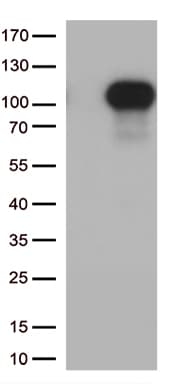 Monoclonal Mouse anti-Human FOXO3 / FOXO3A Antibody (clone OTI6H9, aa374-673, WB)
