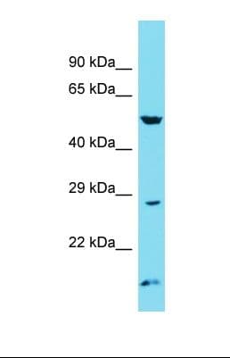 Polyclonal Rabbit anti-Human ATG101 Antibody (aa118-167, WB)