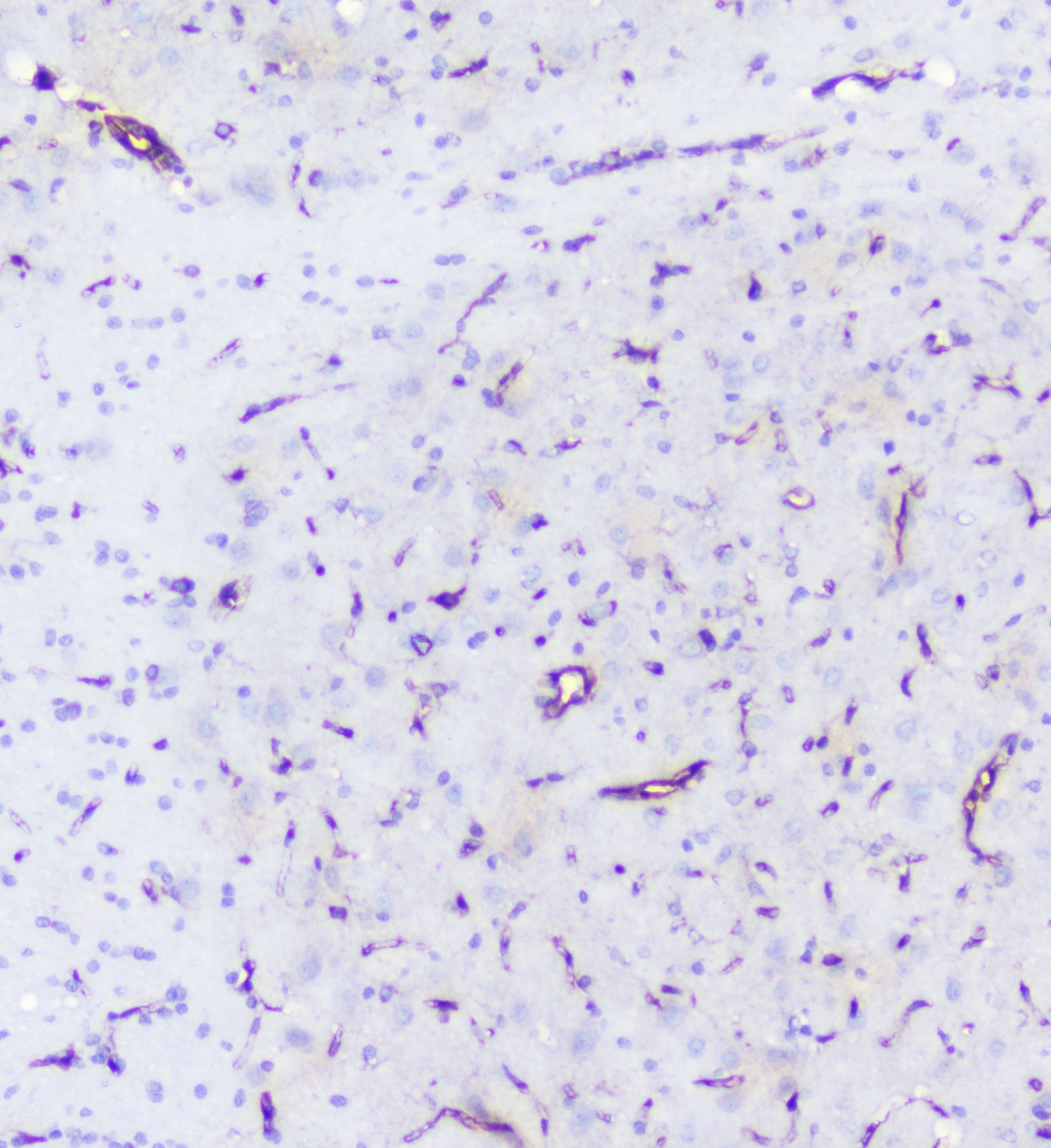 Polyclonal Rabbit anti-Human INPPL1 / SHIP2 Antibody (IHC, WB)