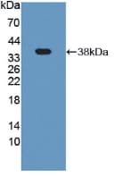 PLG / Plasmin / Plasminogen Antibody (aa191-433, APC)