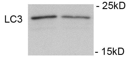 Polyclonal Rabbit anti-Human MAP1LC3A / LC3A Antibody (phospho-Ser12, WB)