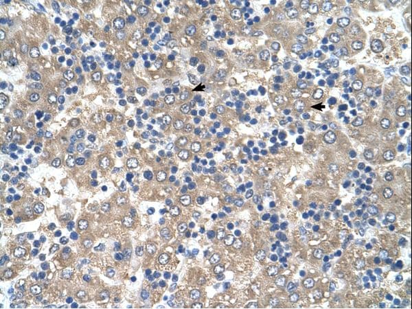 Polyclonal Rabbit anti-Human C3orf10 Antibody (C-Terminus, IHC, WB)