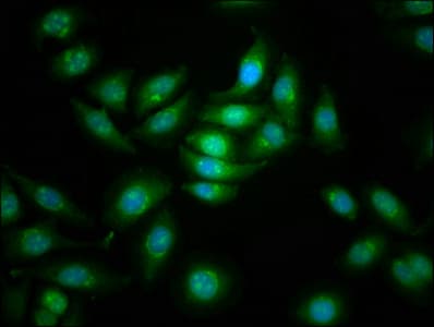 CDC42BPB / MRCKB Antibody