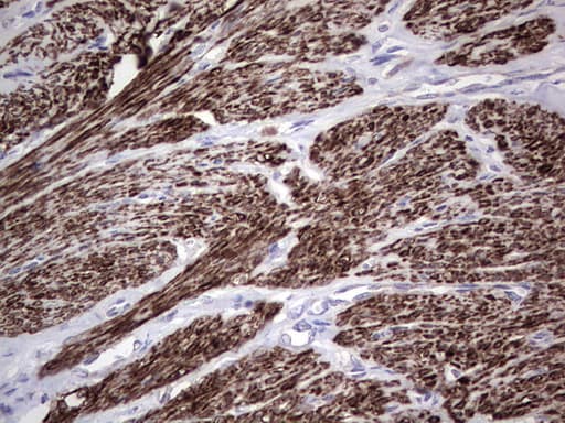 NR1I3 / CAR Antibody (aa1-236, clone OTI1C6)