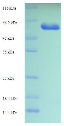 Human CPA6 / Carboxypeptidase A6 Protein (Recombinant His-SUMO)