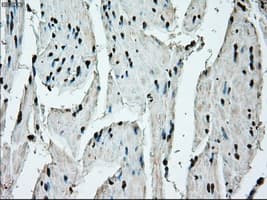 ERCC1 Antibody (clone OTI1A3)