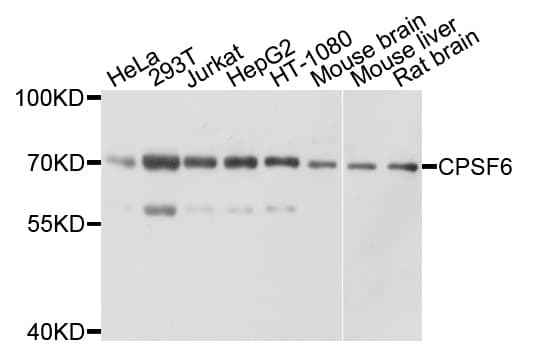 Polyclonal Rabbit anti-Human CPSF6 Antibody (WB)