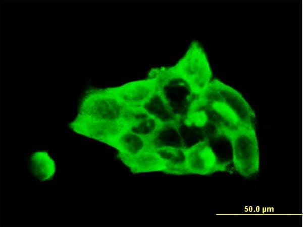 DSC3 / Desmocollin 3 Antibody (clone 4D2)