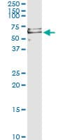 PRF1 / Perforin Antibody (aa461-555, clone 3B4)