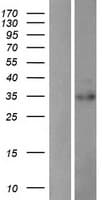 PDIK1L Protein (Over-Expression Lysate Myc-DDK (Flag))