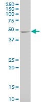 CAMK2A / CaMKII Alpha Antibody (clone 2C4)