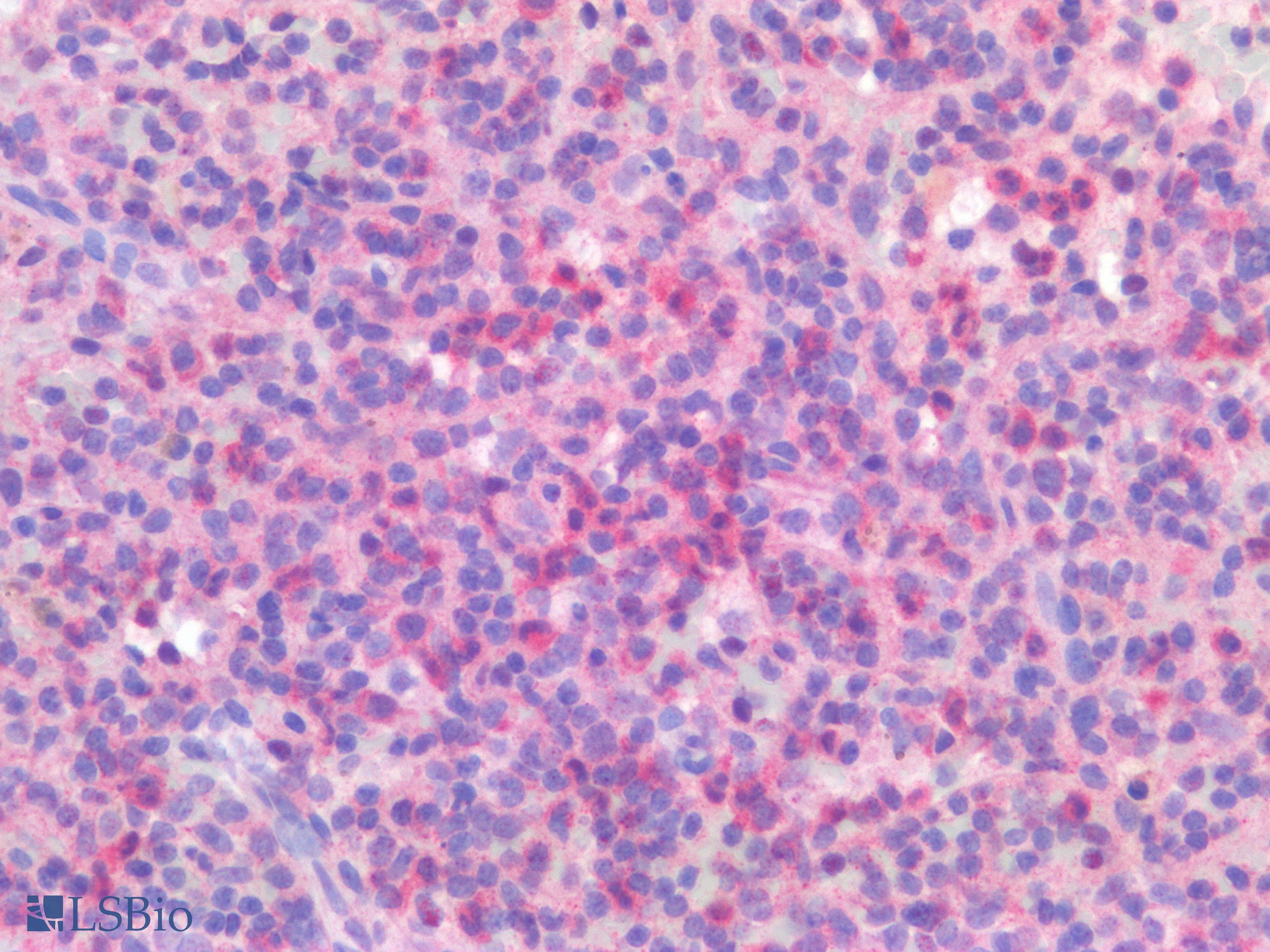 PathPlus™ IL23R Antibody