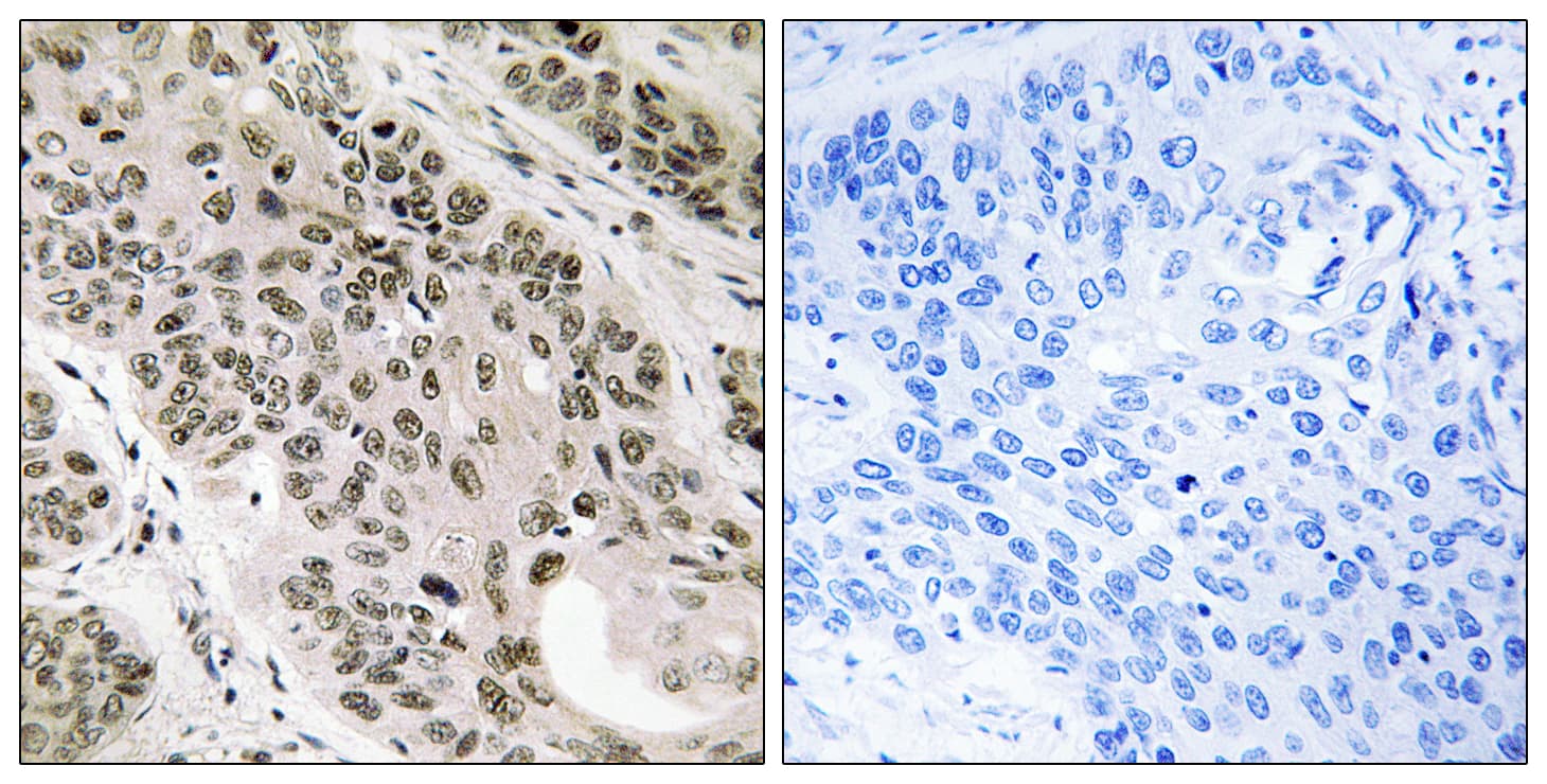 TNNI3K / CARK Antibody (aa301-350)