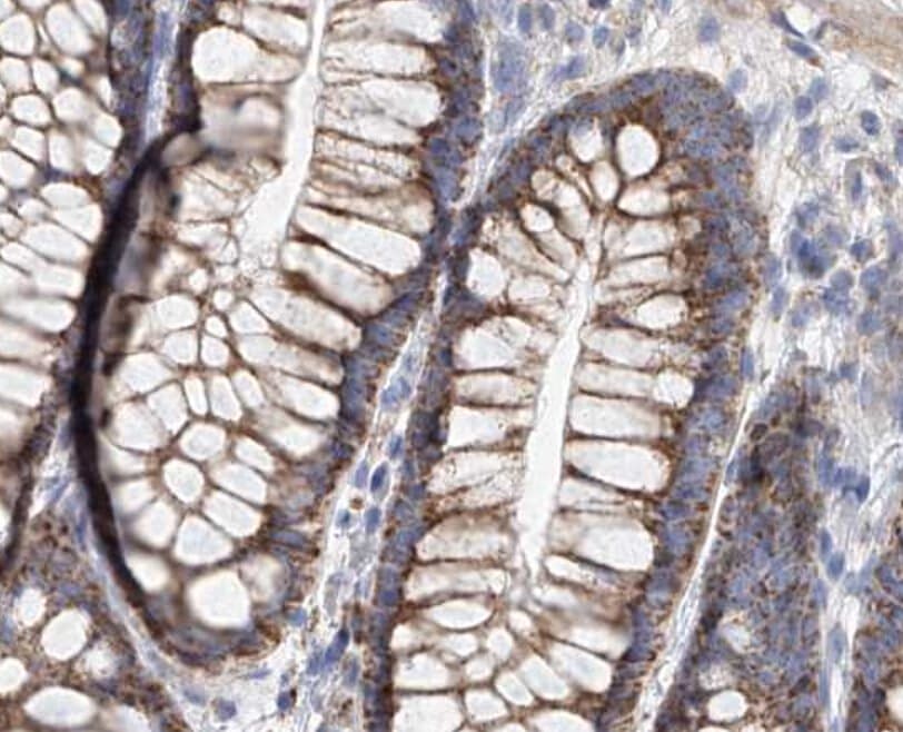 MCL1 / MCL 1 Antibody