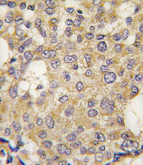 PARG Antibody (aa390-421)
