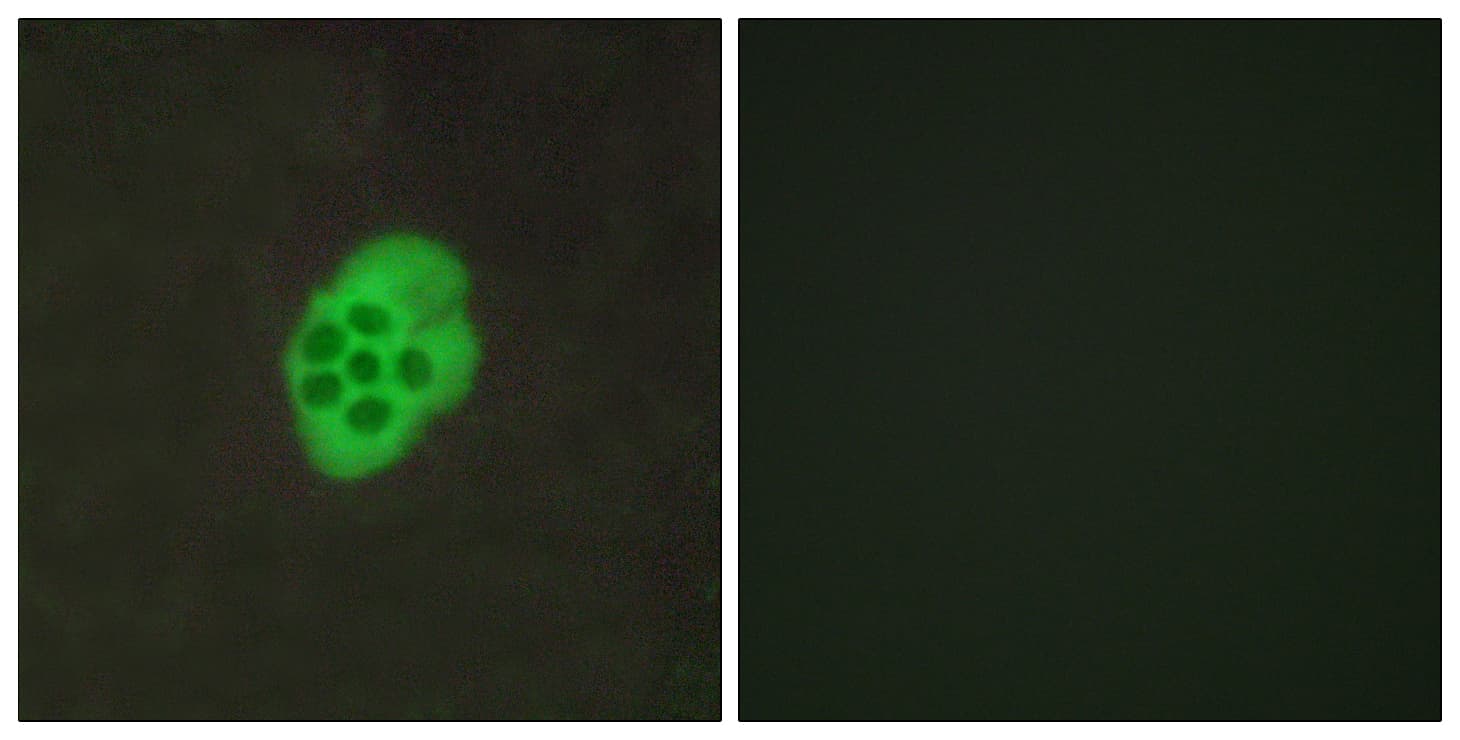 HTR4 / 5-HT4 Receptor Antibody (aa141-190)