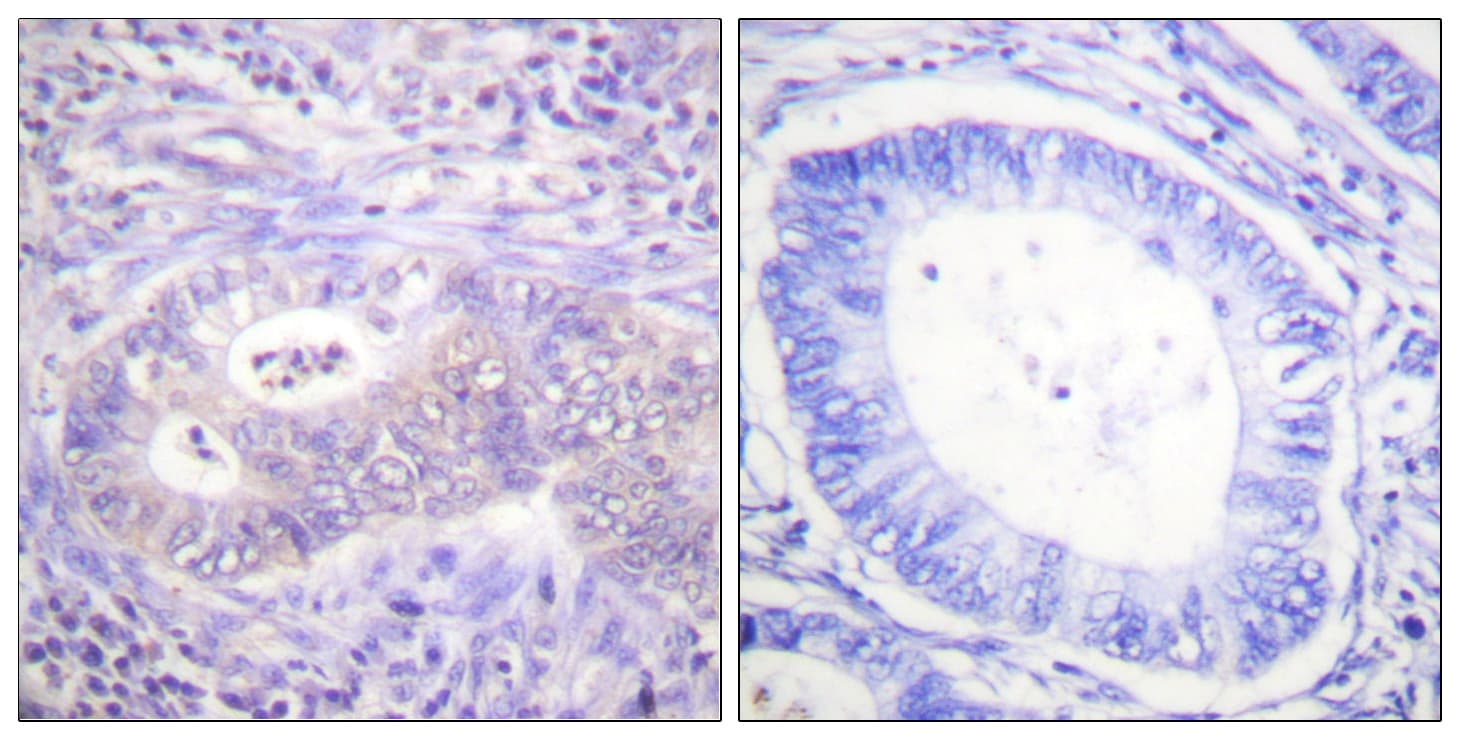 Polyclonal Rabbit anti-Human PFKFB2 Antibody (phospho-Ser483, IHC, WB)