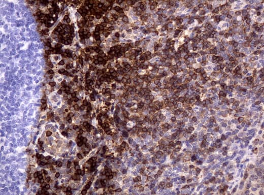 Monoclonal Mouse anti-Human CD3E Antibody (clone UMAB54, IHC, IF, WB)