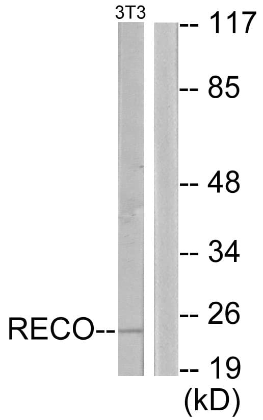 Polyclonal Rabbit anti-Human Recoverin Antibody (aa107-156, WB)