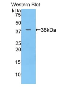 KRT17 / CK17 / Cytokeratin 17 Antibody (aa84-392)