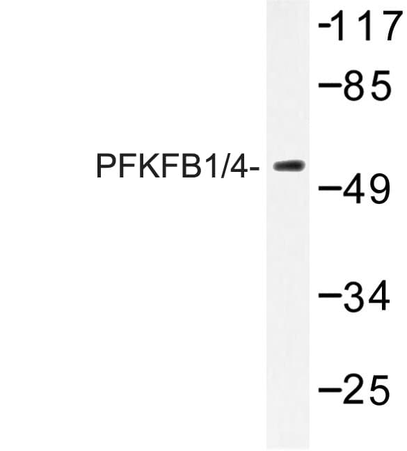PFKFB1+4 Antibody (Glu349)