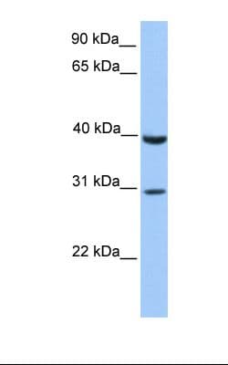 JAZF1 Antibody (C-Terminus)