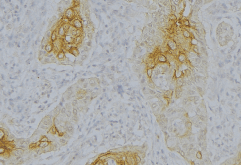 CFB / Complement Factor B Antibody