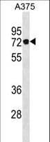 Polyclonal Rabbit anti-Human PODN Antibody (aa571-602, WB)