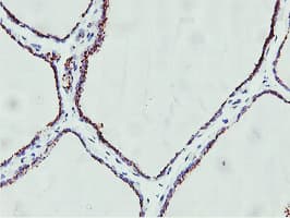 GOLM1 / GP73 / GOLPH2 Antibody (clone OTI4B3, Carrier-free)