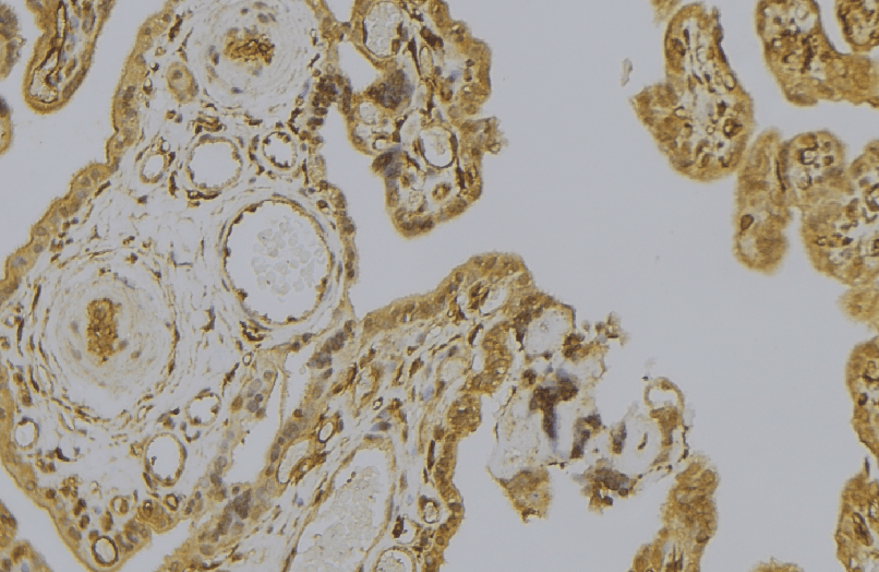 CAPN6 / Calpain 6 Antibody