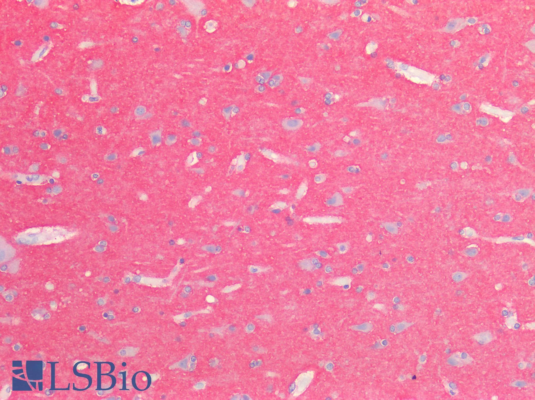 PathPlus™ NCAM / CD56 Antibody
