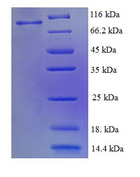 Human RPA70 / RPA1 Protein (Recombinant 6His-SUMO, N-terminus)