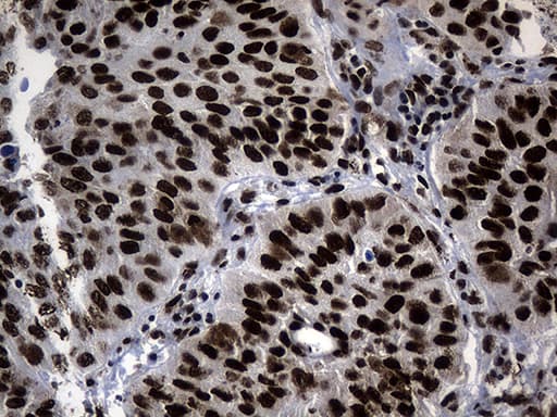 POLR2A / RNA polymerase II Antibody (aa1351-1614, clone OTI2B7)