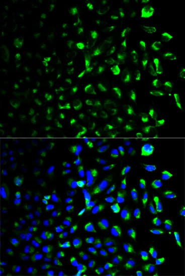 HK1 / Hexokinase 1 Antibody