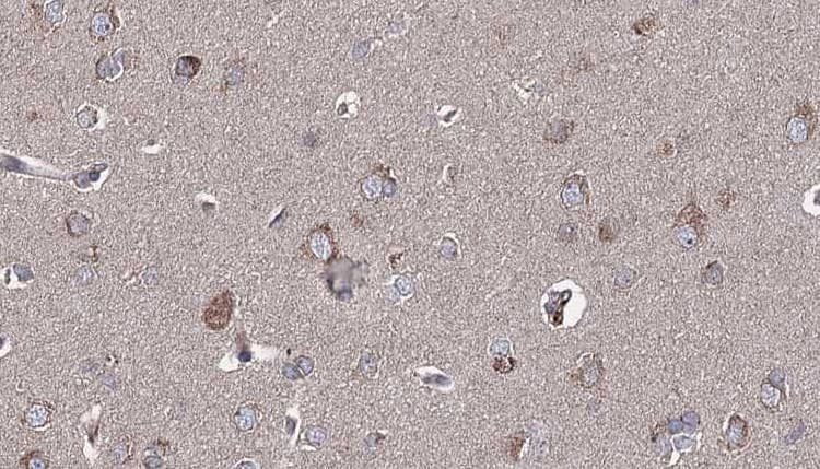 Polyclonal Rabbit anti-Human GRIA1 / GLUR1 Antibody (IHC, IF, WB)