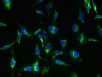 MAS1 / MAS Antibody (aa285-352)