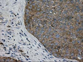 MAC-2-BP / LGALS3BP Antibody (clone 5.00E+03, Carrier-free)