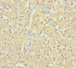 Polyclonal Rabbit anti-Human IDO2 / INDOL1 Antibody (aa1-407, WB)