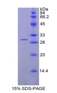 Human IL12A / p35 Protein (Recombinant His, N-Terminal)
